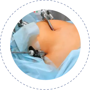 Gastro Surgery in jaipur