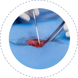 General Surgery in jaipur