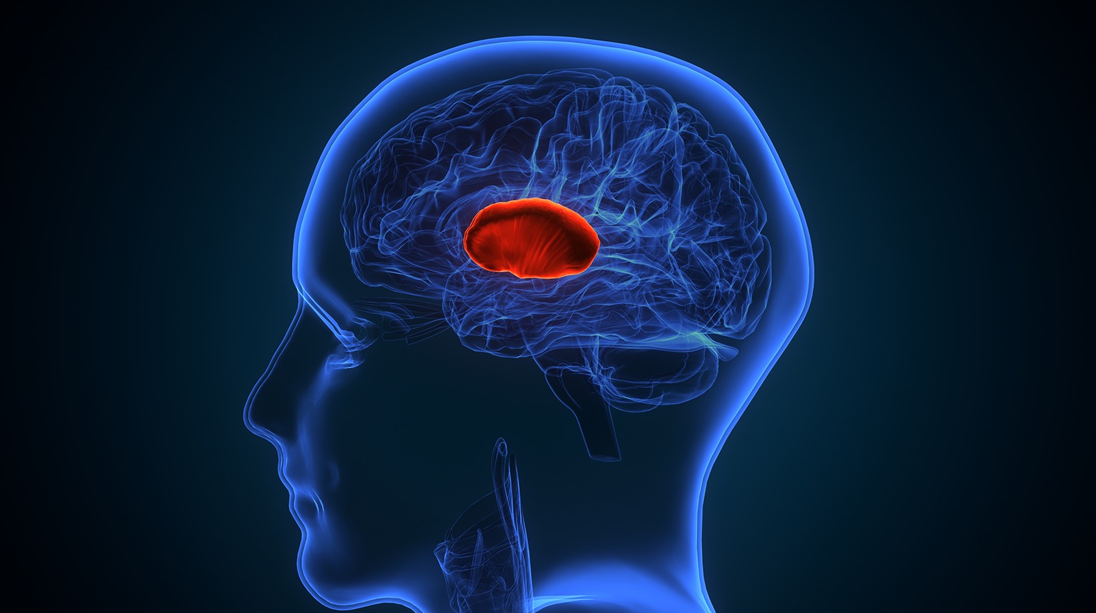 Blood Clot in Brain and symptoms