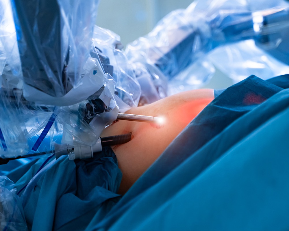 laparoscopic surgery
